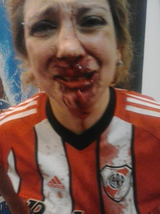 Illustration for article titled Argentine Woman Says She Was Brutally Beaten For Wearing Soccer Jersey